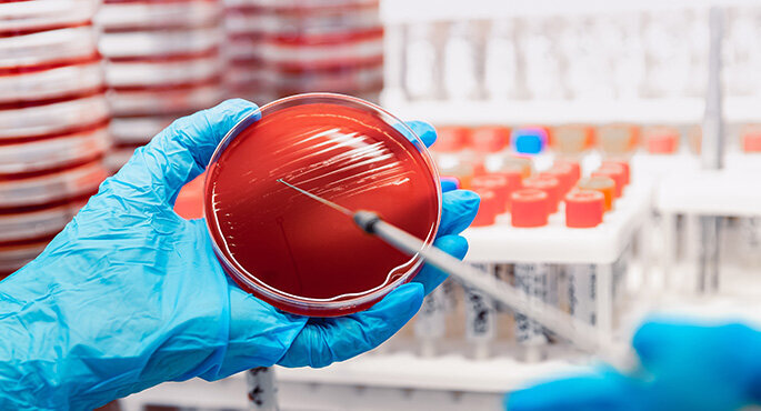 Hands wearing laboratory gloves are holding an agar plate and pipette. More agar plates and test tubes can be seen in the background.
